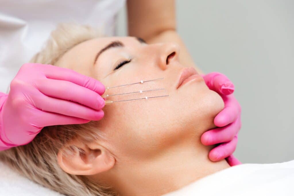 Thread,Lifting,Procediure.,Professional,Cosmetologist,In,Pink,Medical,Gloves,Holding